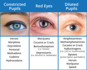 one pupil dilated ritalin